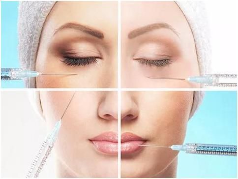 Bi-Phasic Hyaluronic Dermal Filler Injection for Cheek Lip Augmentation