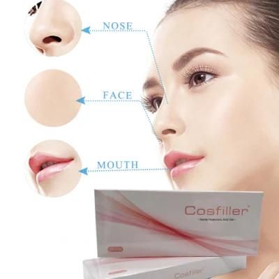 Non Animal Stabilized Fine/ Derm/ Deep/ Extra-Deep Hyaluronic Acid Plastic Surgery Injection Filler