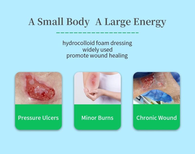 Hydrocolloid Foam Dressing Is Suitable to Heavily Drainage Wound