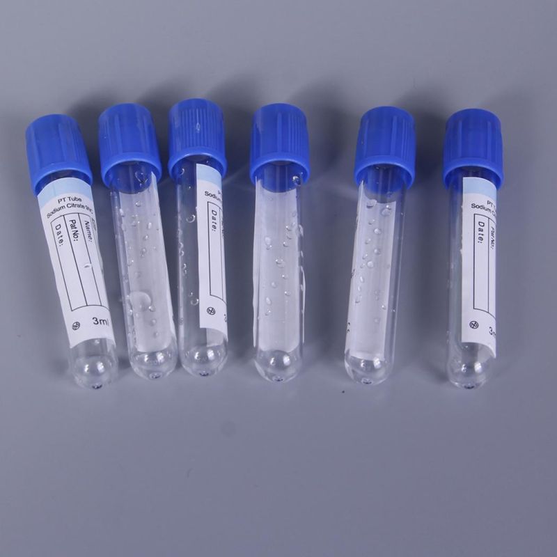 3ml Disposable Plastic Medical Coagulation Mechanism and Blood Preservation Sodium Citrate 9nc Vacuum Blood Collection Tube
