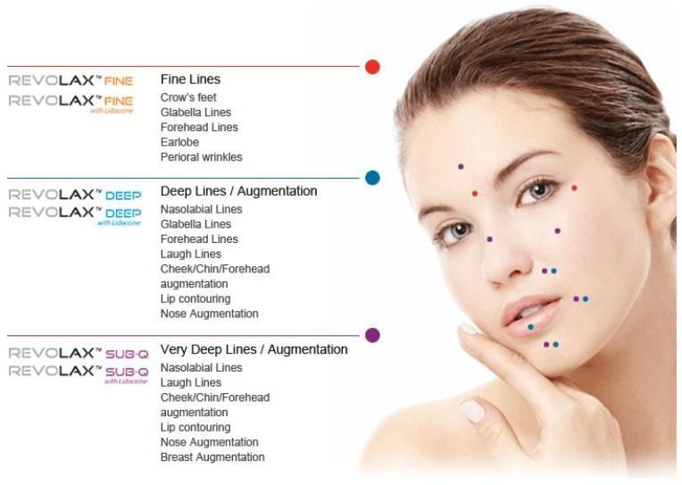 Injection Hyaluronic Dermal Filler Korea Revolax Lips Filler Anti Wrinkle Face Lifting