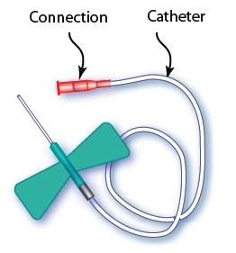 Hot Sales CE Certified Quality Disposable Scalp Vein Set