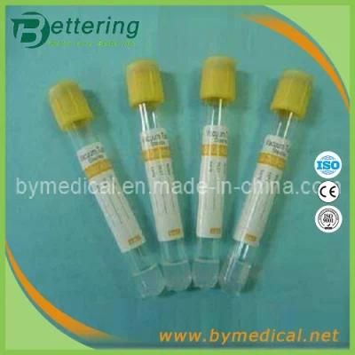 Yellow Cap Clot Vacuum Blood Tubes