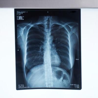 CE Approved Blue Base Inkjet X Ray Film