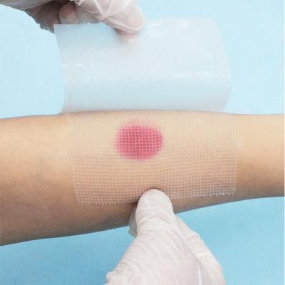 Medical OEM, ISO, CE Approved Sterile Paraffin Gauze, Wound Dressing