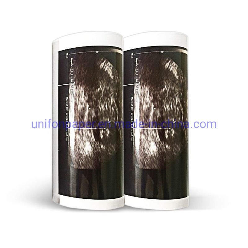 High Glossy Ultrasound Thermal Printing Paper Sony Upp-110hg High Brightness