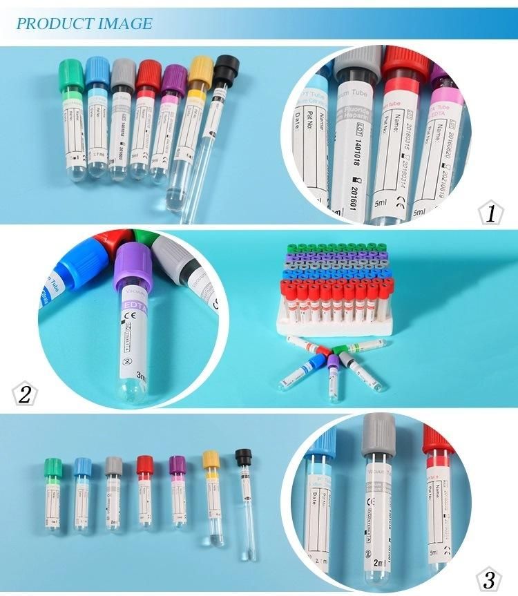 Factory Direct Selling 3-10ml Vacuum Blood Collection Tube