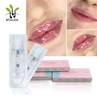 Deep 2ml Hyaluronic Acid Injectable Dermal Filler for Lip Augmentation