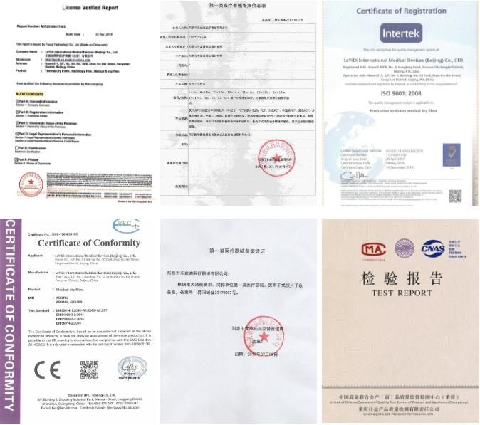 A4, 8*10, 10*12, 14*17 Inch for Hospital Inkjet Medical X-ray Film