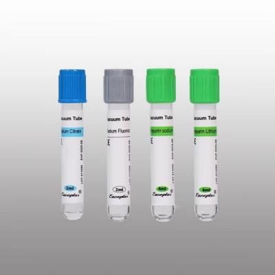 Siny Factory Price Disposable Vacuum Blood Collection Tube Sodium Citrate Tube with CE