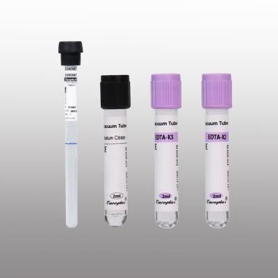 Siny 3.8% Sodium Citrate ESR Blood Collection Vacuum Tubes with CE