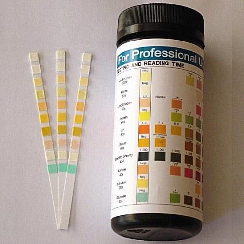 Urine Test Strip/ Urine Glucose Test Strip/ Urinalysis Test Strips/Urine Dipstick Test