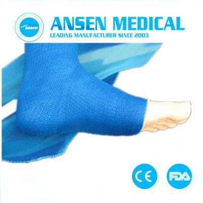 Fiberglass Casting Tape for Hand Medical Consumable Hospital Plaster Hand Fractures with 3D Printing Medical Bandages