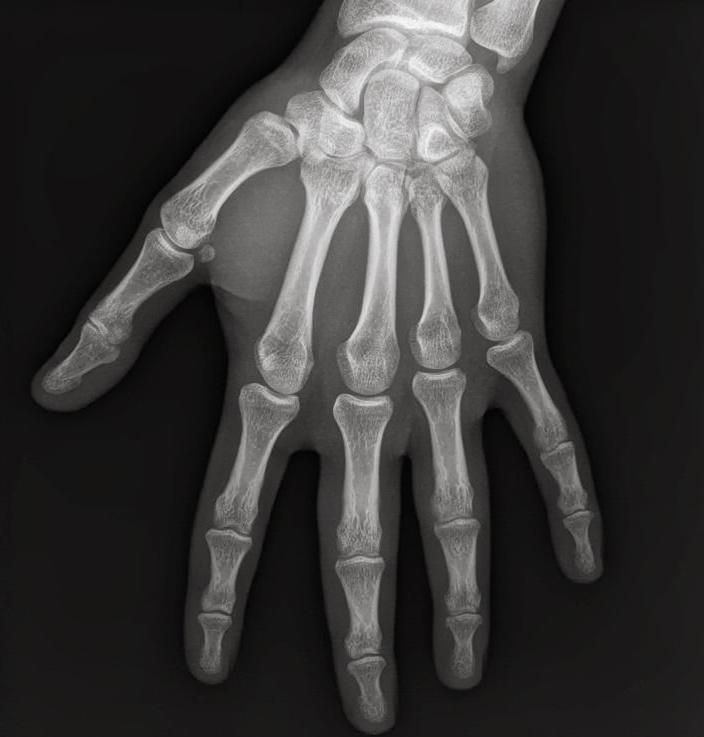 X Ray Inkjet Medical Dry Film for Ink Jet Printer Printing