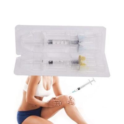 Knee Jointc Dermal Filler Hyaluronic Acid with 0.3% Lido