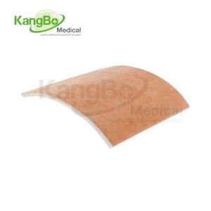 Kb-Swd Superabsorbent Wound Dressing