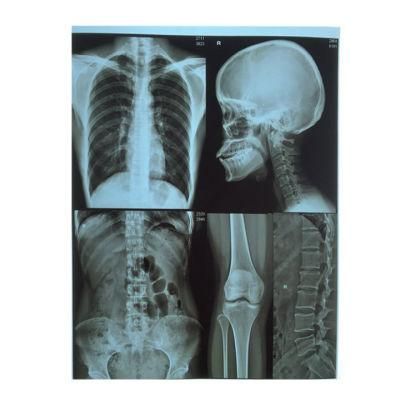 A4 28X35 25X30 Dry Imaging Blue X-ray Medical Film for Inkjet Printers