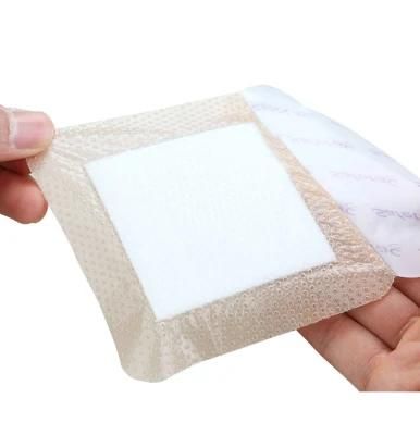 Wholesale OEM Disposable Medical Consumables Breathable Non-Irritating Medical Non-Woven Adhesive Tape