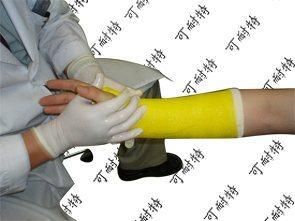 Orthopedic Aid Colored Bandage for Hospital