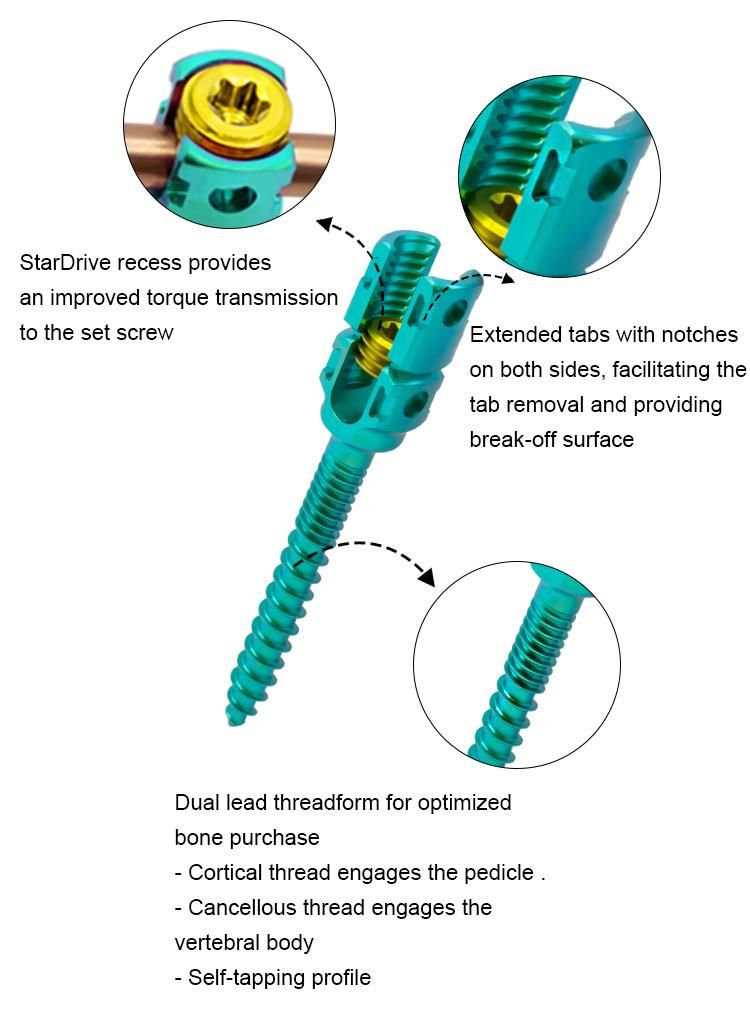 Quality Assured Orthopedic Surgical Implants 5.5mm Monoaxial Pedicle Screw Double Threaded Spine Implant Spinal Pedicle Screw