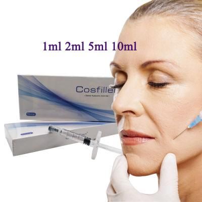 Dermal Filler Cross Linked Hyaluronic Acid Dermal Filler Injected for Facial Periocular Wrinkles