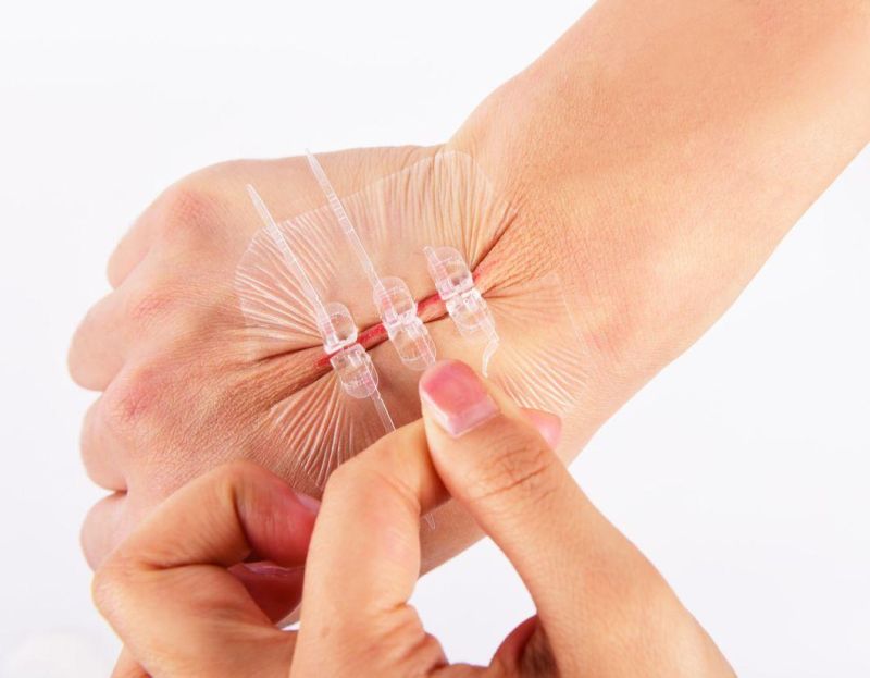 New Design! Medical Skin Adhesive Wound Closure Device Plaster