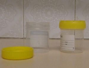 Disposable PP Urine Container for Medical Use