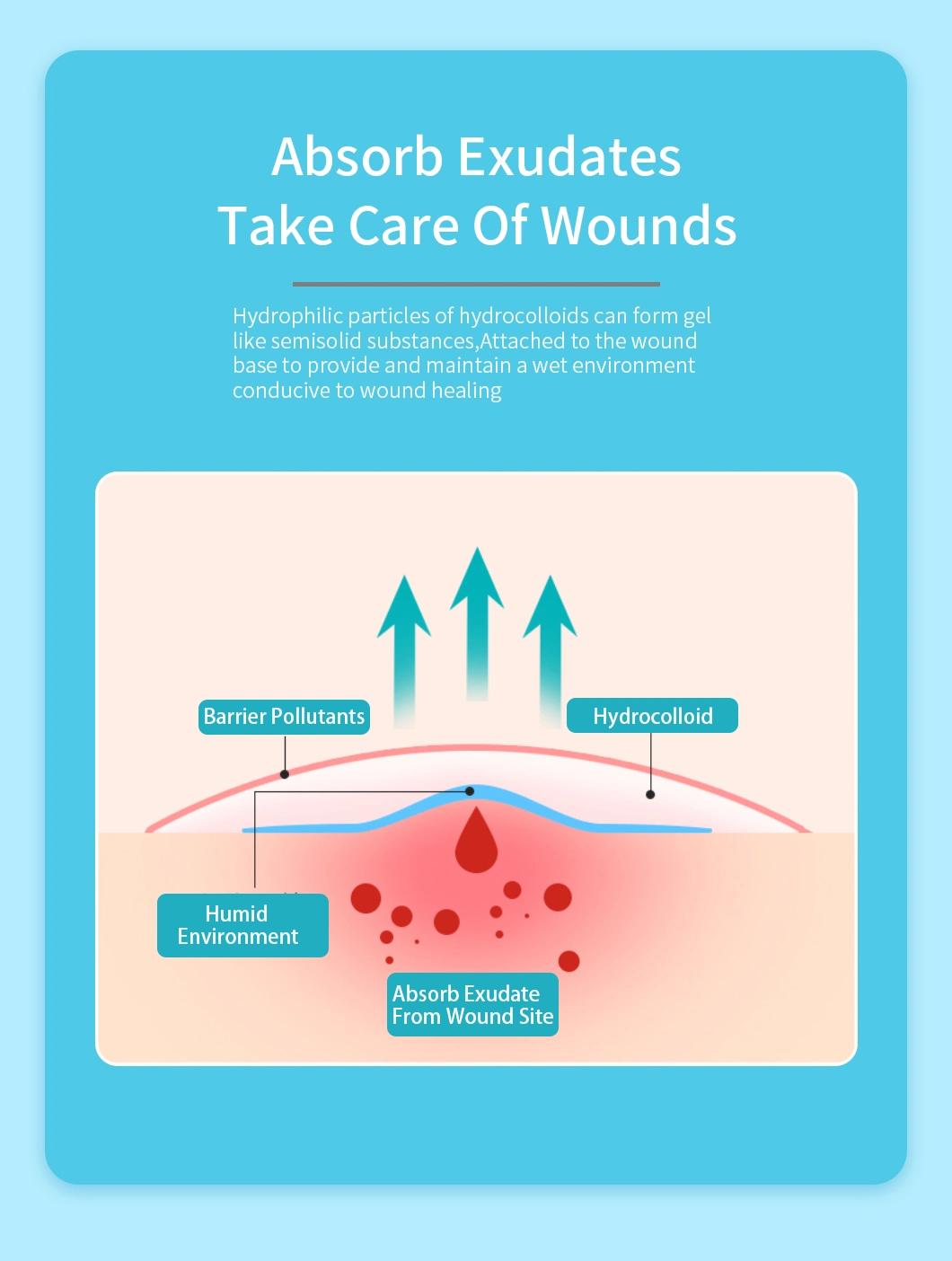 Hydrocolloid Dressing for Superficial Burn Wound