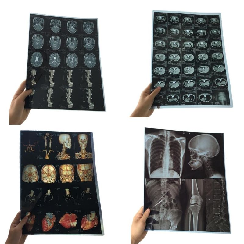 X Ray Thermal/Inkjet Film Medical Images for Clinic and Hospitals