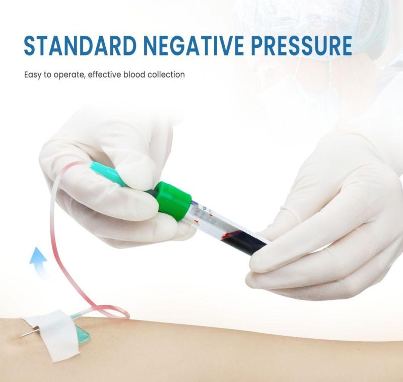 Hospital Medical Vacuum Blood Collection Test Tube CE Approved for Single Use