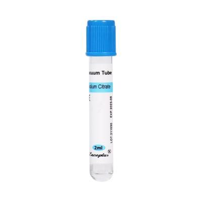 Siny Wholesale Medical Vacuum PT Blood Collection Tube Sodium Citrate with CE