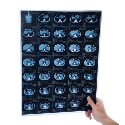 13*17 Medical Inkjet Blue Base Films Digital Image Output 210 Microns Films for Dr Cr X Ray