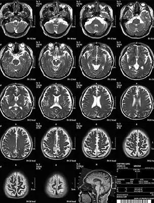 Medical Dry Thermal Imaging Film X-ray CT MRI Waterproof Blue-Based for Printers in Clinics and Hospitals