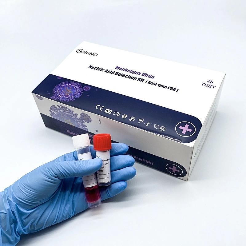 Nucleic Acid Assay Anyi Protection Monkeypox Viru Real-Time PCR Kit