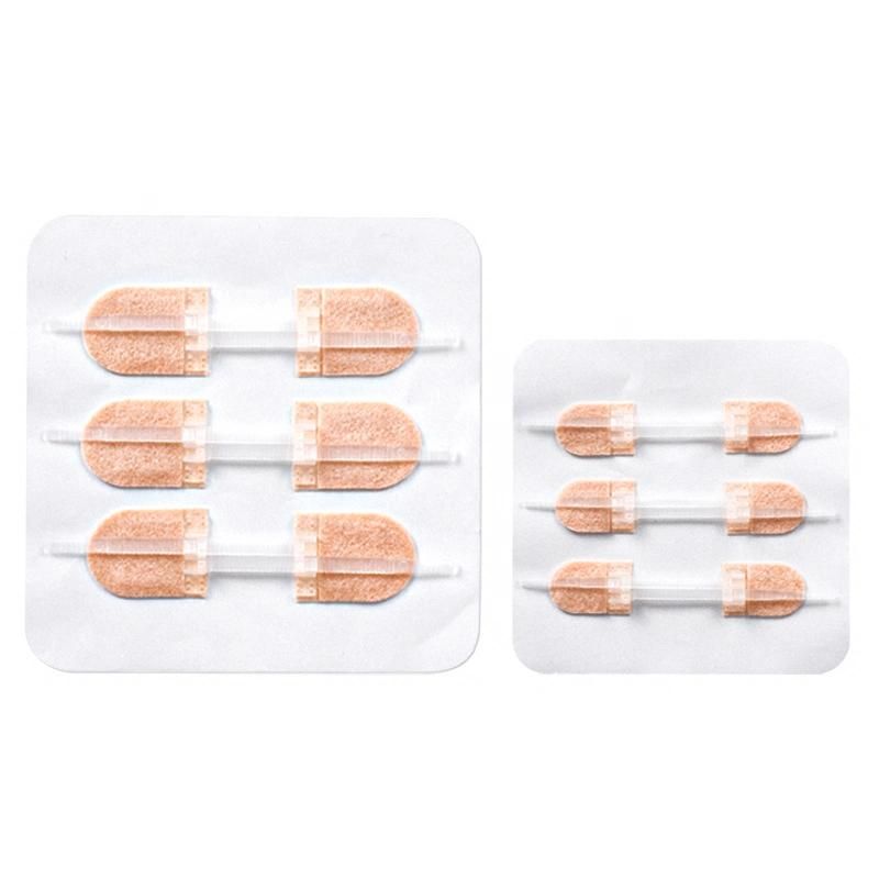Factory Wholesale Surgical Patch Zipper Type Wound Suture Patch