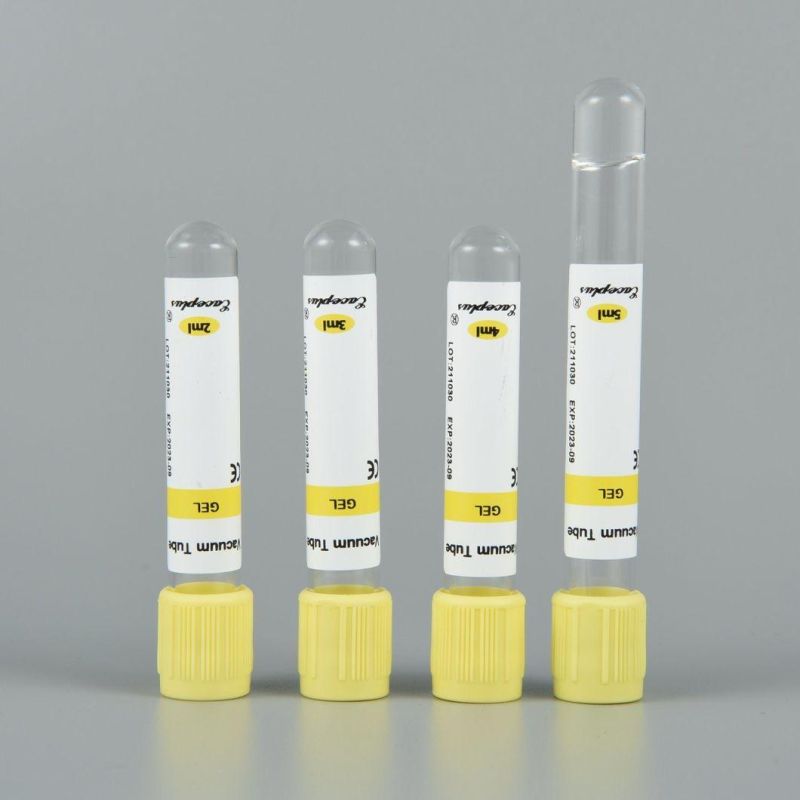 Siny Medical Disposable Serum Vacuum Blood Collection Tubes Gel Tube