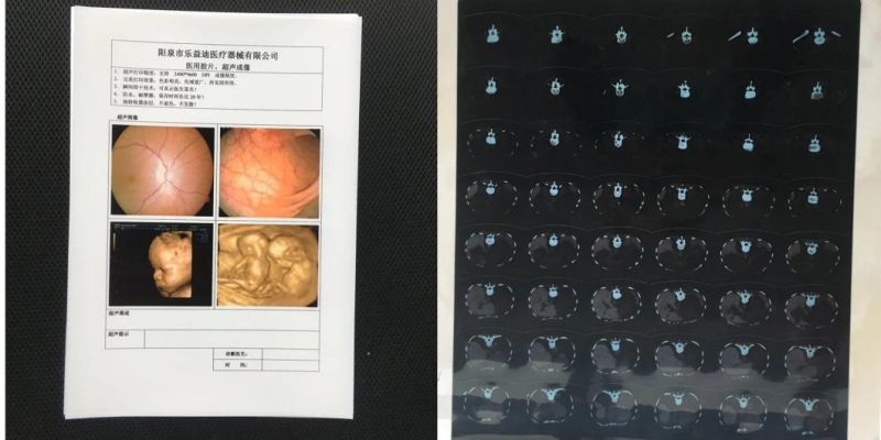 Medical X-ray Laser Films 14X17 / 35X43