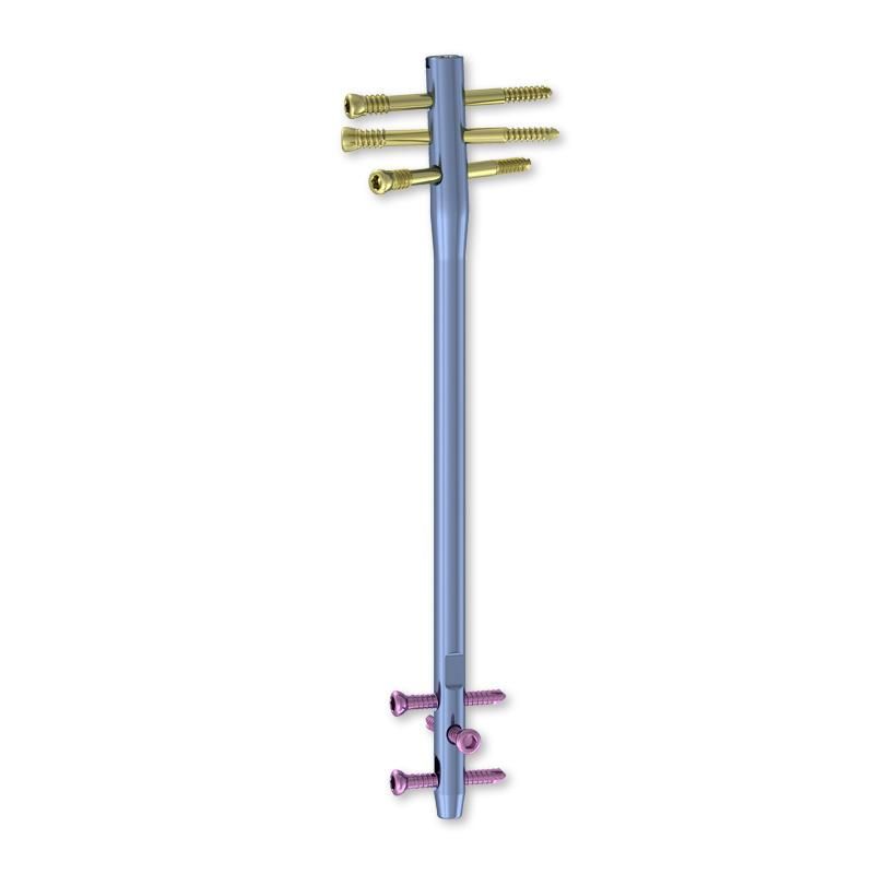 Main Product Femoral Reverse Intramedullary Nail Medical Equipment