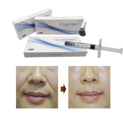 Cross-Linked Dermal Filler Hyaluronic Acid Fine Derm Deep Subskin Filler for Lip/ Eye /Nose /Cheek/ Chin /Tear Trough Filler