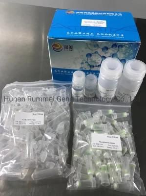 Hot Sales Virus Nucleic Acid Extraction Kit or Nucleic Acid Detection Test Kits