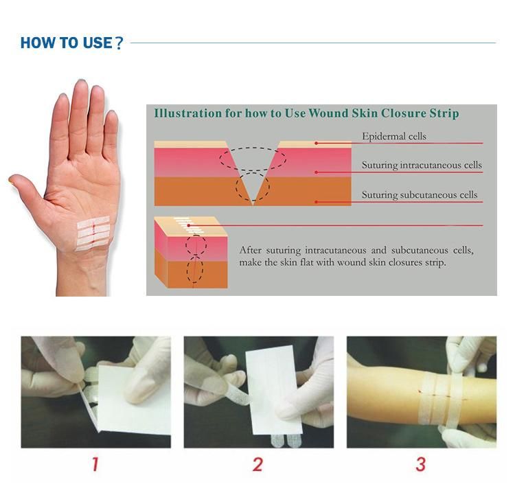 High Quality Surgical Skin Closure Strip for Hurt Stab or Cut Wound