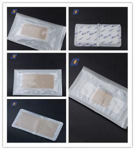 Medical Disposable Surgical Adhesive Wound Dressing
