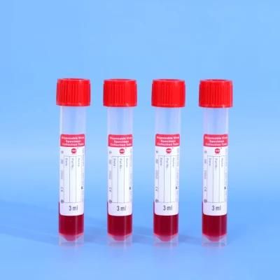 Universal Transport Medium Diagnostics Biological Virus Specimen Collection Tube Nasal Throat Swab Virus Sampling Tube