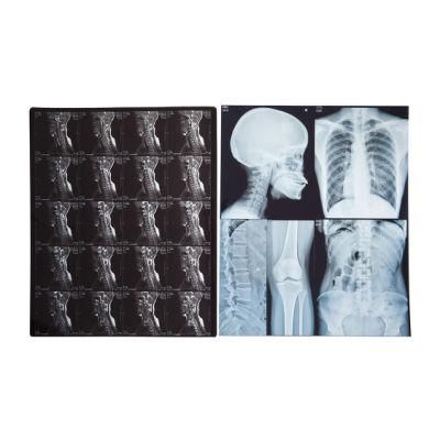 11X14 Inch Medical X-ray Film/Analogue Medical Film/Dry Film