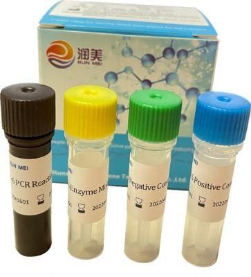 Diphtheria Bacillus (ToxB gene) Nucleic Acid Detection Pre-Packed Kit (fluorescence PCR method)