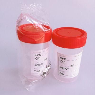Factory Direct China Hot Products Disposable Medical 60ml Urine Specimen Container