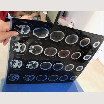 Waterproof A4 Pet Xray Blue Sheet Medical Pet Film for Digital Printing