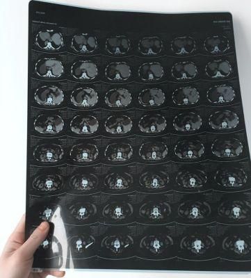 Medical X Ray Dry Inkjet Film, Clear Coated Film, Blue Film