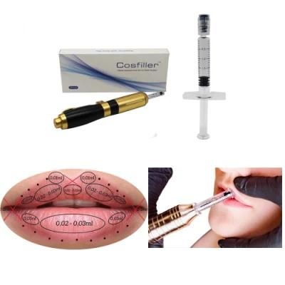 Acid Hialuronic Fillers Cheek Hialuronic Acid Injectable Dermal Lip Injections Hyaluron Pen Filler