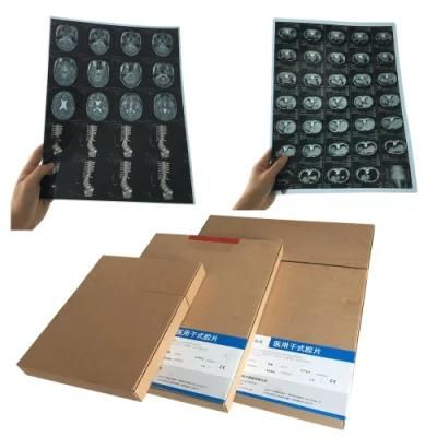 Cheap Medical Blue Sensitive Inkjet Medical X-ray Film Price